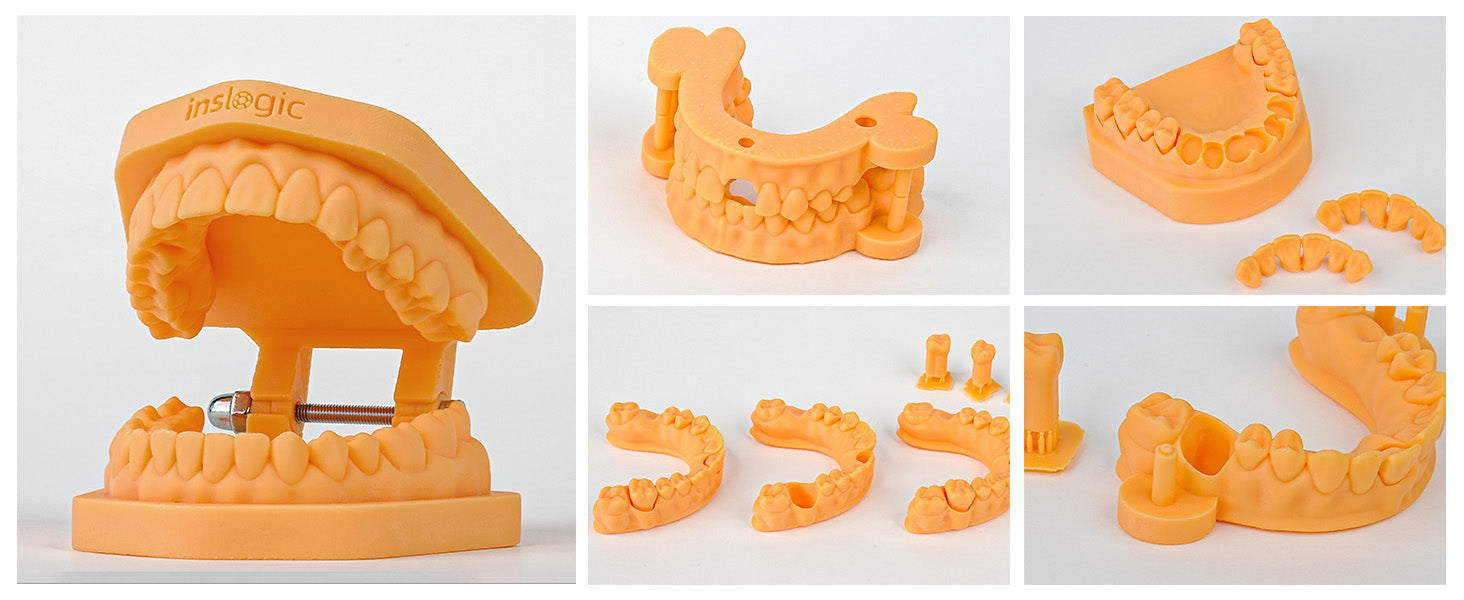Dental Model Printed with Inslogic Dental Implant Model Resin